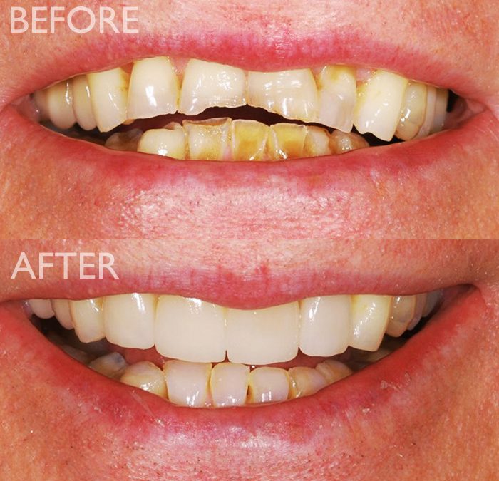 About Serenity Dental Case Studies. Before and after routine treatments and cosmetic dentistry